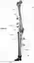 Fig. 16 - CLAMPING DEVICES FOR EXTERNAL FIXATION DEVICE