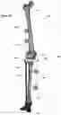 Fig. 20 - CLAMPING DEVICES FOR EXTERNAL FIXATION DEVICE