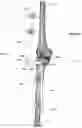 Fig. 21 - CLAMPING DEVICES FOR EXTERNAL FIXATION DEVICE