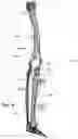 Fig. 26 - CLAMPING DEVICES FOR EXTERNAL FIXATION DEVICE