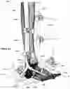 Fig. 32 - CLAMPING DEVICES FOR EXTERNAL FIXATION DEVICE
