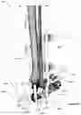 Fig. 33 - CLAMPING DEVICES FOR EXTERNAL FIXATION DEVICE
