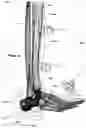 Fig. 35 - CLAMPING DEVICES FOR EXTERNAL FIXATION DEVICE