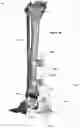 Fig. 37 - CLAMPING DEVICES FOR EXTERNAL FIXATION DEVICE
