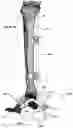 Fig. 41 - CLAMPING DEVICES FOR EXTERNAL FIXATION DEVICE