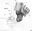 Fig. 44 - CLAMPING DEVICES FOR EXTERNAL FIXATION DEVICE