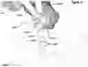 Fig. 45 - CLAMPING DEVICES FOR EXTERNAL FIXATION DEVICE