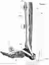 Fig. 52 - CLAMPING DEVICES FOR EXTERNAL FIXATION DEVICE