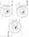Fig. 77 - CLAMPING DEVICES FOR EXTERNAL FIXATION DEVICE