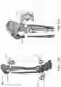 Fig. 93 - CLAMPING DEVICES FOR EXTERNAL FIXATION DEVICE