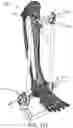Fig. 97 - CLAMPING DEVICES FOR EXTERNAL FIXATION DEVICE