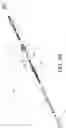 Fig. 10 - Strut assemblies and external fixation systems