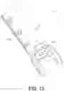 Fig. 16 - Strut assemblies and external fixation systems