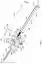 Fig. 03 - Spinal Fixation Assembly