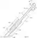 Fig. 08 - Spinal Fixation Assembly