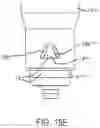 Fig. 11 - RECEIVING PART AND INSTRUMENT FOR HOLDING THE RECEIVING PART