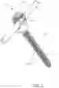 Fig. 02 - MODULAR TENSIONED SPINAL SCREW