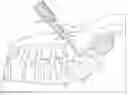 Fig. 01 - Spinal fixation tool attachment structure