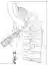 Fig. 14 - Spinal fixation tool attachment structure