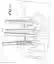 Fig. 17 - Spinal fixation tool attachment structure