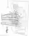 Fig. 19 - Spinal fixation tool attachment structure