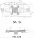 Fig. 19 - Anterior cervical plate assembly