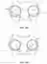 Fig. 28 - Anterior cervical plate assembly
