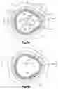 Fig. 08 - Bone plates having multi-use screw holes for locking and compression screws, and related systems and methods