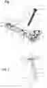 Fig. 02 - Osteosynthesis device with plate provided with a threaded hole for receiving a locked fastening screw