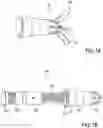 Fig. 02 - BONE IMPLANTS FOR THE TREATMENT OF INFECTION