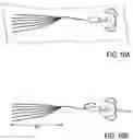 Fig. 09 - BONE IMPLANTS FOR THE TREATMENT OF INFECTION