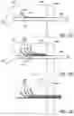 Fig. 14 - BONE IMPLANTS FOR THE TREATMENT OF INFECTION
