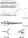 Fig. 15 - BONE IMPLANTS FOR THE TREATMENT OF INFECTION