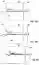 Fig. 19 - BONE IMPLANTS FOR THE TREATMENT OF INFECTION
