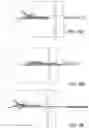 Fig. 20 - BONE IMPLANTS FOR THE TREATMENT OF INFECTION