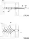 Fig. 21 - BONE IMPLANTS FOR THE TREATMENT OF INFECTION