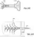 Fig. 23 - BONE IMPLANTS FOR THE TREATMENT OF INFECTION