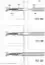 Fig. 25 - BONE IMPLANTS FOR THE TREATMENT OF INFECTION