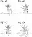 Fig. 05 - Cryogenic applicator