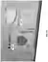 Fig. 13 - DEVICES, SYSTEMS, AND METHODS FOR CRYOABLATION