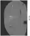 Fig. 14 - DEVICES, SYSTEMS, AND METHODS FOR CRYOABLATION