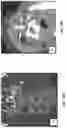 Fig. 20 - DEVICES, SYSTEMS, AND METHODS FOR CRYOABLATION