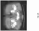 Fig. 27 - DEVICES, SYSTEMS, AND METHODS FOR CRYOABLATION