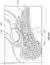 Fig. 103 - Vapor-based ablation treatment methods with improved treatment volume vapor management