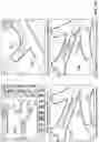 Fig. 113 - Vapor-based ablation treatment methods with improved treatment volume vapor management