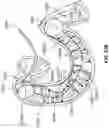 Fig. 99 - Vapor-based ablation treatment methods with improved treatment volume vapor management