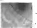 Fig. 08 - MICROFLUIDIC CHIP FOR ATTRACTING AND DESTROYING A SPECIFIC BIOLOGICAL ELEMENT