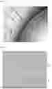 Fig. 11 - MICROFLUIDIC CHIP FOR ATTRACTING AND DESTROYING A SPECIFIC BIOLOGICAL ELEMENT