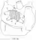 Fig. 08 - Ablation devices and methods of use