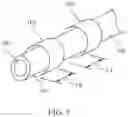 Fig. 06 - Method and apparatus for rapid and selective transurethral tissue ablation